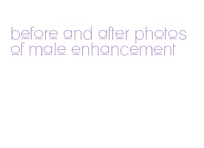 before and after photos of male enhancement