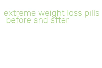 extreme weight loss pills before and after