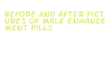 before and after pictures of male enhancement pills