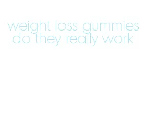 weight loss gummies do they really work