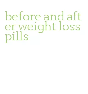 before and after weight loss pills