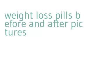 weight loss pills before and after pictures