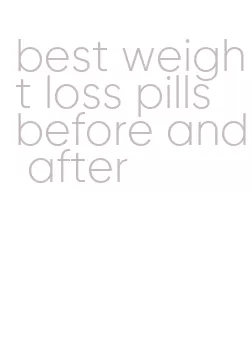 best weight loss pills before and after