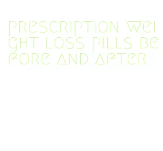 prescription weight loss pills before and after