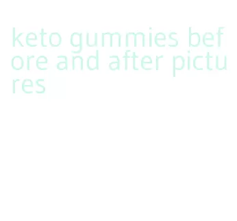 keto gummies before and after pictures