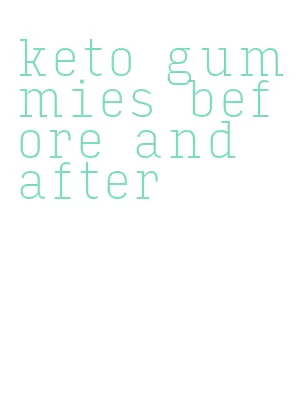 keto gummies before and after