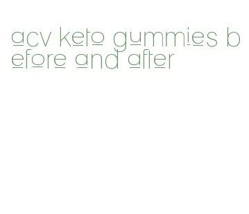 acv keto gummies before and after