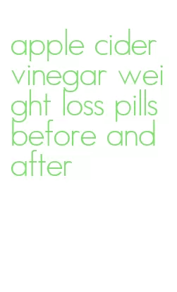apple cider vinegar weight loss pills before and after