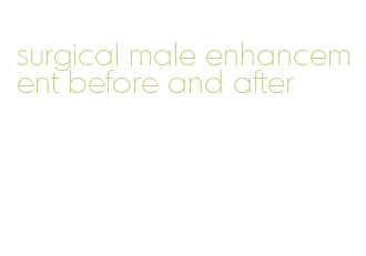 surgical male enhancement before and after