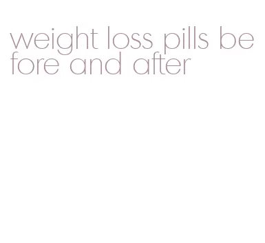 weight loss pills before and after