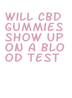 will cbd gummies show up on a blood test
