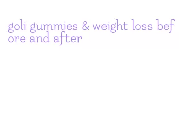 goli gummies & weight loss before and after