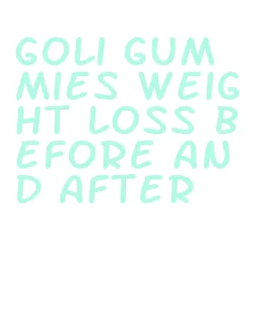 goli gummies weight loss before and after